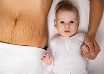 Vergetures et grossesse : prendre soin de sa peau après l’accouchement